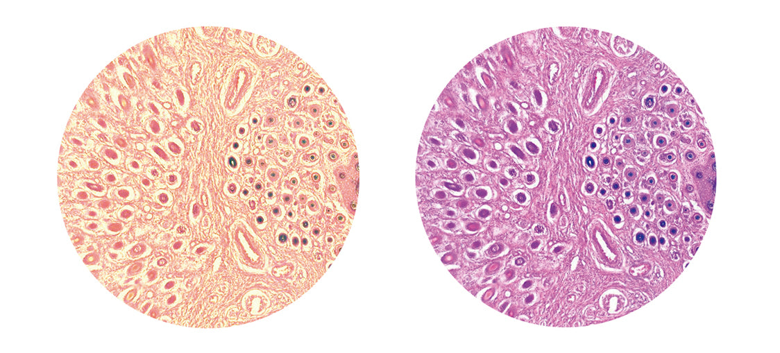 Basic Microscopy Concepts - Adjusting The Illumination